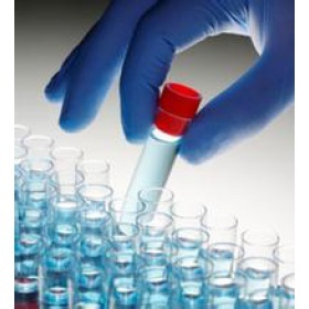 膜鐵轉(zhuǎn)運(yùn)蛋白(FPN)多克隆抗體(Mouse_上海鈺博生物科技